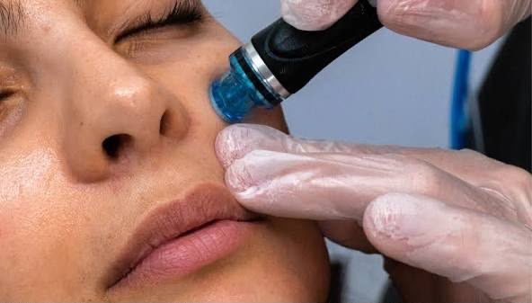 HydraFacial advanced skin treatment